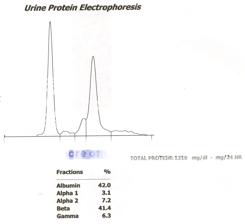 Urine Protein Electrophoresis Photo by labdoc Photobucket